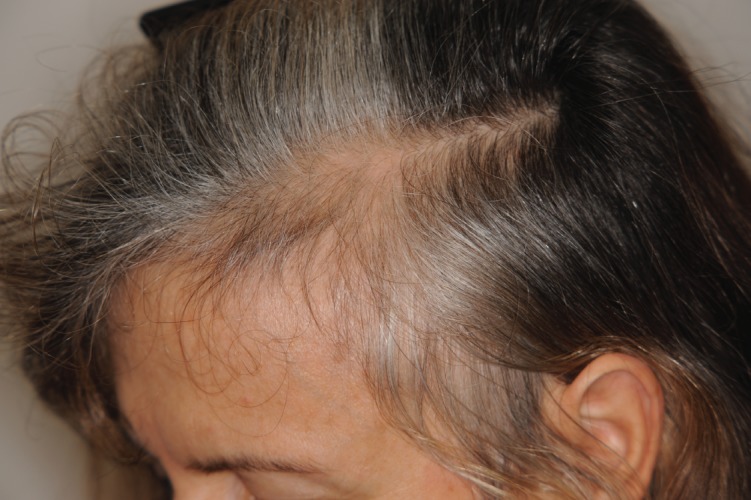 An external file that holds a picture, illustration, etc.
Object name is ijem-11-04-9860-g002.jpg