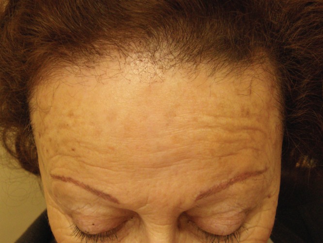 An external file that holds a picture, illustration, etc.
Object name is ijem-11-04-9860-g003.jpg