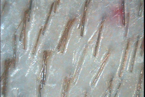 C:\TrichoSciencePro v 1.4 RUS\report_10341250\report_10341250\4.jpg