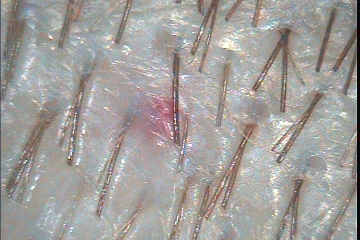 C:\TrichoSciencePro v 1.4 RUS\report_10341250\report_10341250\8.jpg