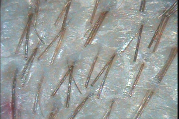 C:\TrichoSciencePro v 1.4 RUS\report_10341250\report_10341250\6.jpg