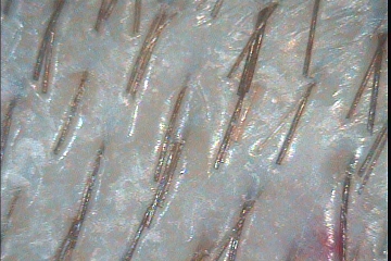 C:\TrichoSciencePro v 1.4 RUS\report_10341250\report_10341250\7.jpg