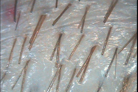 C:\TrichoSciencePro v 1.4 RUS\report_10341250\report_10341250\0.jpg