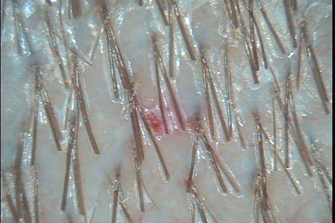 C:\TrichoSciencePro v 1.4 RUS\report_15053093\report_15053093\6.jpg