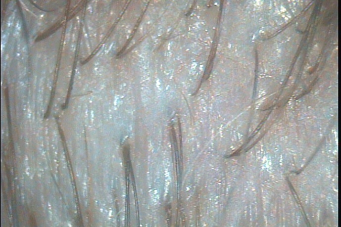 C:\TrichoSciencePro v 1.4 RUS\report_180593609\report_180593609\6.jpg