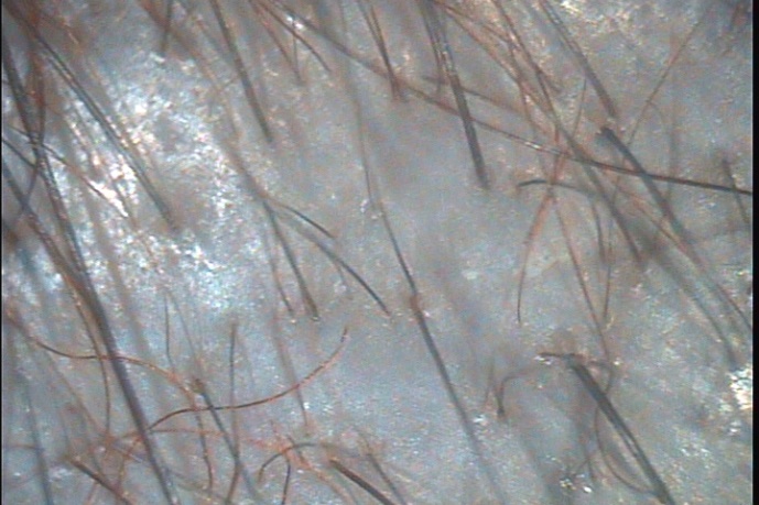 C:\TrichoSciencePro v 1.4 RUS\report_18749031\report_18749031\2.jpg