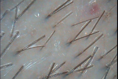 C:\TrichoSciencePro v 1.4 RUS\report_21085562\report_21085562\2.jpg