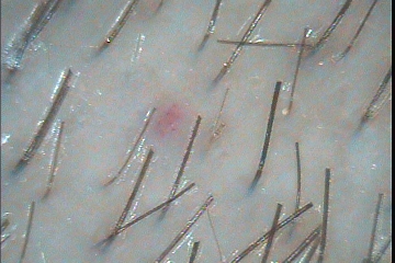 C:\TrichoSciencePro v 1.4 RUS\report_21085562\report_21085562\6.jpg