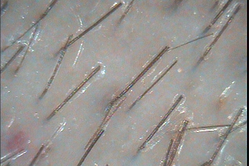 C:\TrichoSciencePro v 1.4 RUS\report_21085562\report_21085562\4.jpg