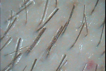 C:\TrichoSciencePro v 1.4 RUS\report_21085562\report_21085562\5.jpg