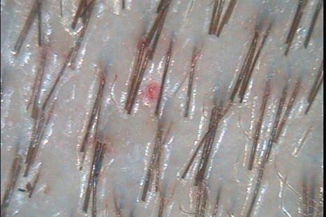 C:\TrichoSciencePro v 1.4 RUS\report_28134484\report_28134484\10.jpg