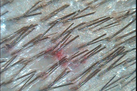 C:\TrichoSciencePro v 1.4 RUS\report_28134484\report_28134484\4.jpg