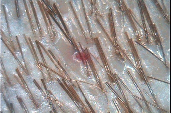 C:\TrichoSciencePro v 1.4 RUS\report_29258875\report_29258875\4.jpg